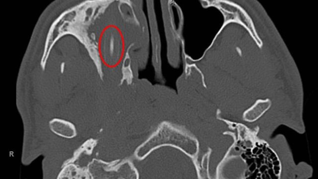 483047-130530-pencil-in-head