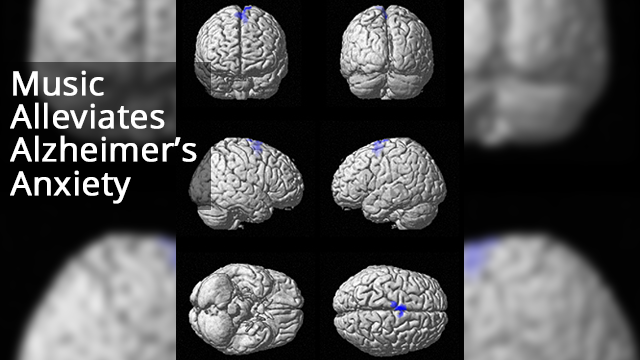 Music Activates Regions of the Brain Spared by Alzheimer’s Disease – It ...