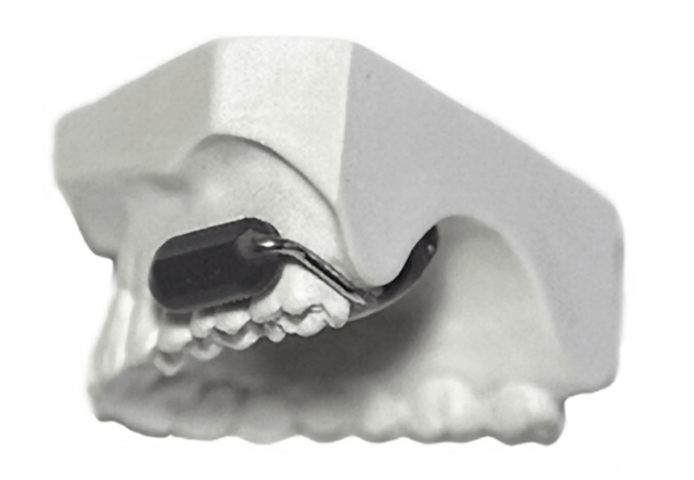 molar-mike-on-cast--598x414px-1